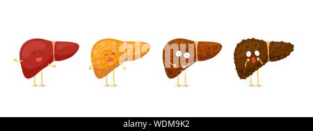 Fasi del concetto di danno al fegato umano. Steatosi epatica sana fibrosi e cirrosi. Illustrazione della condizione della mascotte reversibile e irreversibile del vettore cartoon medico Illustrazione Vettoriale