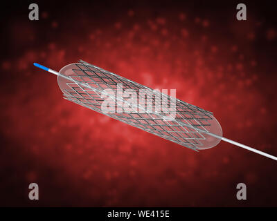 3D rendering stent o catetere per angioplastica a palloncino Foto Stock