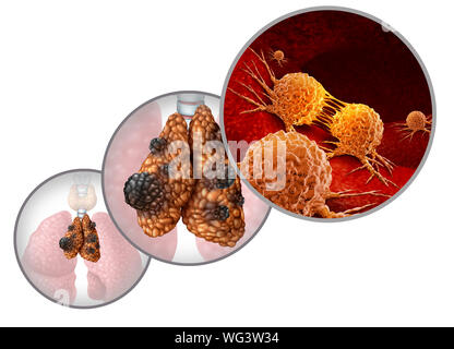 Il timo il cancro o la malattia di timoma e carcinoma timico la malattia come un premistoppa anatomia con malattia maligna crescente mutando la crescita cellulare come un'icona. Foto Stock