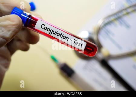 La coagulazione - Test con il campione di sangue. Vista superiore isolata sulla scrivania in ufficio. Assistenza sanitaria/concetto medico Foto Stock
