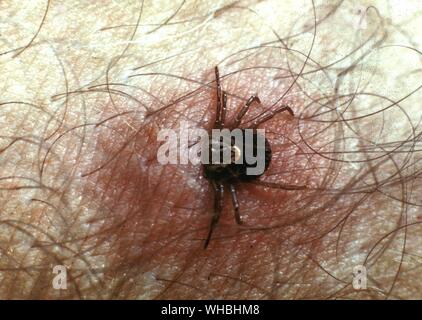 Vista al microscopio di un segno di spunta su un braccio umano , Brasile Foto Stock