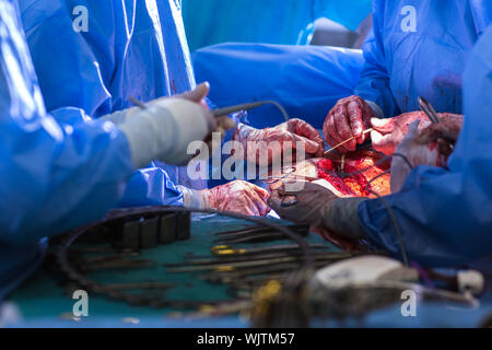 Il team di chirurghi di eseguire un intervento su un paziente in un ospedale (SHALLOW DOF; dai toni di colore immagine) Foto Stock