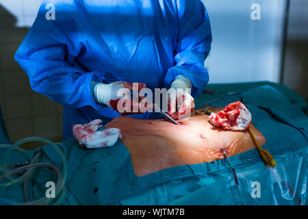Chirurgo di eseguire un intervento su un paziente in un ospedale (SHALLOW DOF; dai toni di colore immagine) Foto Stock