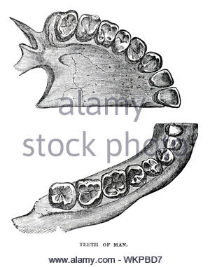 Denti dell'uomo, vintage illustrazione da 1884 Foto Stock