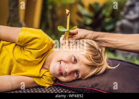 Il ragazzo riceve una procedura con un orecchio candela, bambini le orecchie salute, buona audizione, cerume Foto Stock