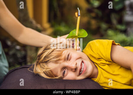 Il ragazzo riceve una procedura con un orecchio candela, bambini le orecchie salute, buona audizione, cerume Foto Stock