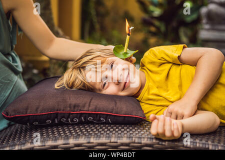 Il ragazzo riceve una procedura con un orecchio candela, bambini le orecchie salute, buona audizione, cerume Foto Stock