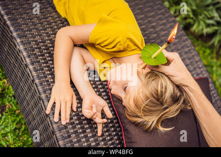 Il ragazzo riceve una procedura con un orecchio candela, bambini le orecchie salute, buona audizione, cerume Foto Stock