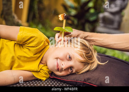 Il ragazzo riceve una procedura con un orecchio candela, bambini le orecchie salute, buona audizione, cerume Foto Stock