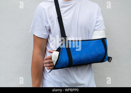 Uomo con braccio rotto avvolto medical calco in gesso e bendaggio blu. Cast in fibra di vetro che coprono il polso e il braccio a gomito dopo sport incidente, isolati su wh Foto Stock