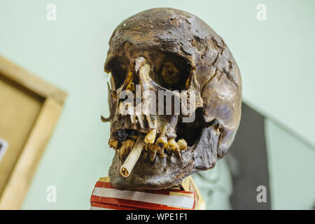 Cranio umano con la sigaretta, anti-fumo concetto. Foto Stock