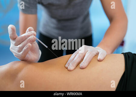 Dettaglio foto di mani coperte da guanti medicali, inserendo un ago piccolo in una gamba del paziente. Concetto di rilassamento. Close-up Foto Stock