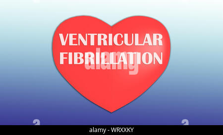 3D illustrazione della fibrillazione ventricolare titolo sul cuore rosso, isolata su gradiente blu. Foto Stock