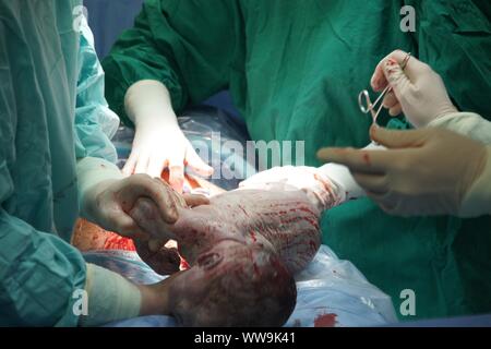 Lubin, Polonia. 31 ott 2009. Parto Cesareo in un 42-anno-vecchia ragazza. La procedura è stata completata con successo. Il principale nella foto è un ragazzo. È consuetudine quando una donna è al di sopra dei 40 anni per eseguire un taglio cesareo. Indicazioni mediche anche sostenere questa soluzione quando è necessario procedere rapidamente a salvare la vita della madre e del bambino Credito: Piotr Twardysko-Wierzbicki/ZUMA filo/Alamy Live News Foto Stock