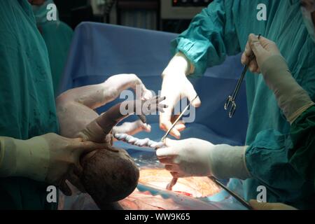 Lubin, Polonia. 31 ott 2009. Parto Cesareo in un 42-anno-vecchia ragazza. La procedura è stata completata con successo. Il principale nella foto è un ragazzo. È consuetudine quando una donna è al di sopra dei 40 anni per eseguire un taglio cesareo. Indicazioni mediche anche sostenere questa soluzione quando è necessario procedere rapidamente a salvare la vita della madre e del bambino Credito: Piotr Twardysko-Wierzbicki/ZUMA filo/Alamy Live News Foto Stock