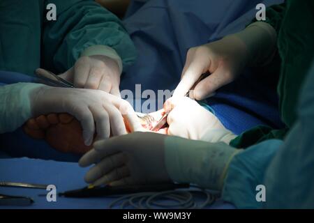 Lubin, Polonia. 31 ott 2009. Un 22-anno-vecchio uomo con lesioni della caviglia è andato all'ospedale per ortopedia. una frattura multipla la frattura è stato scoperto durante lo studio. In questo caso, un'operazione era necessario, che è stata un completo successo Credito: Piotr Twardysko-Wierzbicki/ZUMA filo/Alamy Live News Foto Stock