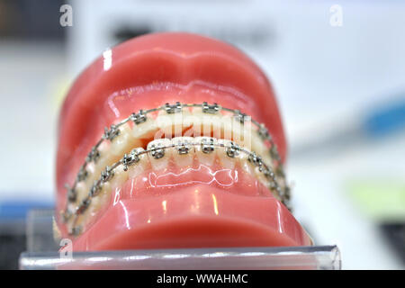 Bretelle sul modello delle ganasce umano, dente dentale odontoiatria close-up Foto Stock