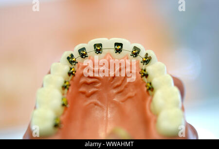 Bretelle sul modello della parte inferiore dei denti umani, dente dentale odontoiatria close-up Foto Stock