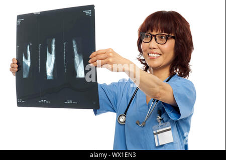 Medico donna revisione x-ray relazione del suo paziente. Tiro al coperto Foto Stock