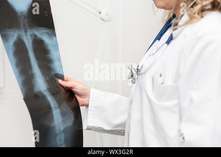 Medico donna esaminando una radiografia Foto Stock