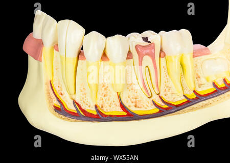 Modello di osso mandibolare umana con denti su sfondo nero Foto Stock