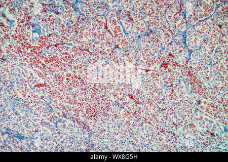 Tessuto ipofisario sotto il microscopio 100x Foto Stock