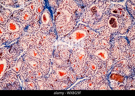 Il tessuto tiroide sotto il microscopio 200x Foto Stock