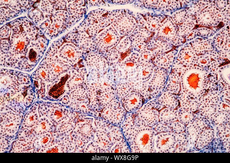 Il tessuto tiroide sotto il microscopio 200x Foto Stock