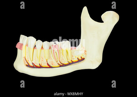 Modello di osso mandibolare umana con denti su sfondo nero Foto Stock