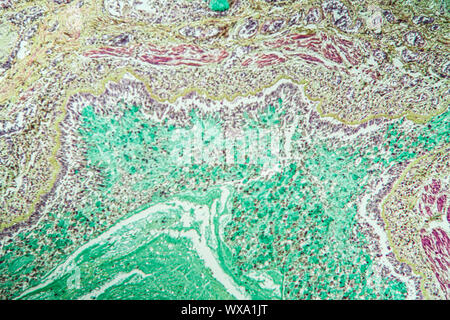 Asma tessuto polmonare sotto il microscopio 100x Foto Stock