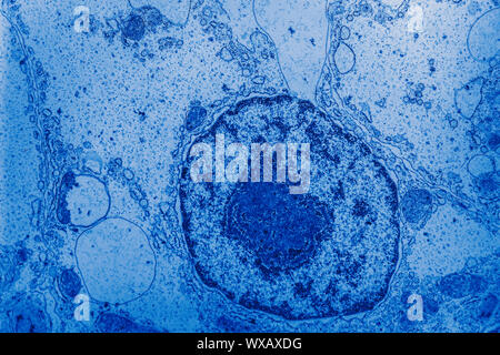 Nucleo sotto il microscopio elettronico 10.000x Foto Stock
