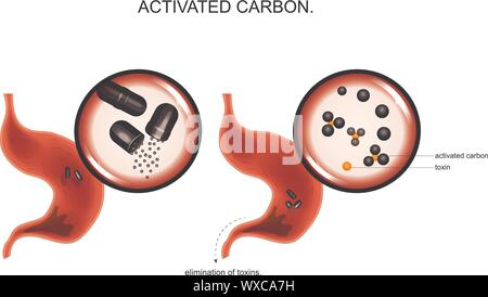 Illustrazione vettoriale dell'azione di carbonio attivato su tossine nello stomaco. Illustrazione Vettoriale