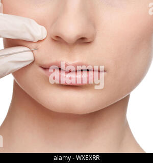 Cosmetici iniezione di Botox nel volto femminile. Zona di labbra, isolato Foto Stock