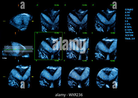 Immagine colorata dei moderni monitor ad ultrasuoni. Ecografia macchina. Alta tecnologia medica e attrezzature sanitarie. Imaging a ultrasuoni o sonogra Foto Stock