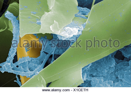 Scanning Electron microfotografia acqua non trattata campione