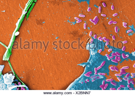 Scanning Electron microfotografia acqua non trattata campione