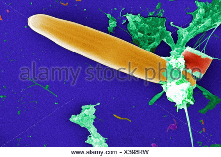 Scanning Electron microfotografia acqua non trattata campione