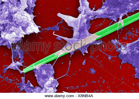 Scanning Electron microfotografia acqua non trattata campione