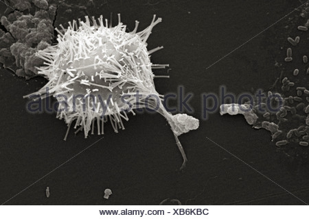 Scanning Electron microfotografia acqua non trattata campione